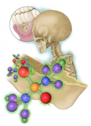 Bisphosphonates and Osteonecrosis of the Jaw